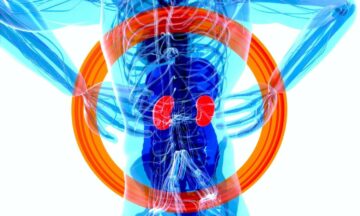 Cannabis Use Linked To—But Lacks Causal Effect In—Chronic Kidney Disease