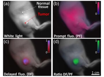 Отсроченная флуоресцентная визуализация помогает идентифицировать раковую ткань во время операции.