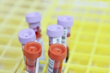 US FDA grants EUA for DiaCarta’s QuantiVirus MPXV test