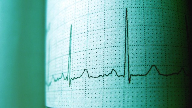 Konkurrerande pacemakers skapar distinkta trillingar i hjärtslag