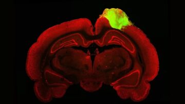 Menschliche Mini-Gehirne, die in verletzte Ratten eingepfropft wurden, stellten ihr Sehvermögen wieder her