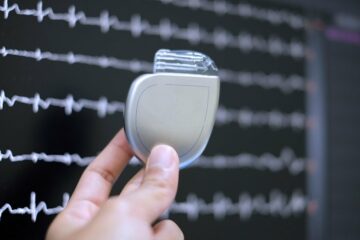 New development in the implantable cardioverter defibrillator market