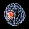 Få medikamenter over blod-hjerne-barrieren ved hjelp av nanopartikler