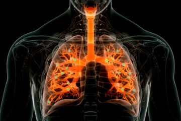 새로운 나노입자는 폐에서 유전자 편집을 수행할 수 있습니다.
