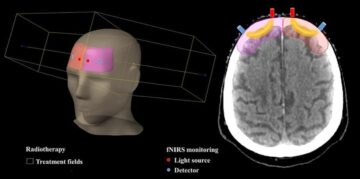 Моніторинг оксигенації тканин мозку в режимі реального часу може персоналізувати променеву терапію