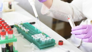 Virax, EU에 AIV 실시간 PCR 테스트 키트 공급