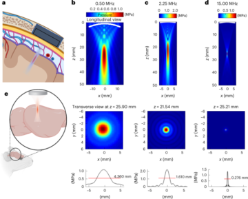 Ectopic expression of a mechanosensitive channel confers spatiotemporal resolution to ultrasound stimulations of neurons for visual restoration