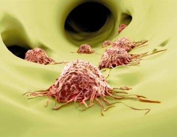 Sphere Fluidics begins work with partners on 3DSecret program to investigate mechanisms of metastasis in cancer