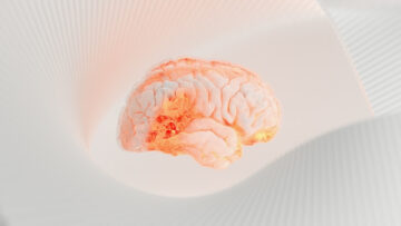 Хірурги моделюють цілий мозок, щоб визначити джерело судом у своїх пацієнтів
