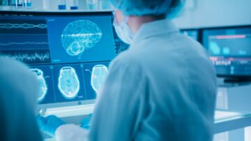 EMVision začenja II. fazo preskušanja prenosnega skenerja možganov