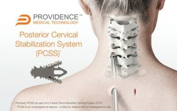 Providence Medical Technology Announces Completion of Enrollment in the FUSE Clinical Study for High-Risk Cervical Fusion Patients | BioSpace