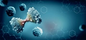 Studie: AI kan forutsi kreft i bukspyttkjertelen tre år foran menneskelige leger