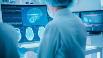 Ezra vinner FDA-godkännande för ny AI-teknik för att förbättra hjärnavbildning