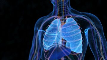 Bệnh nhân đầu tiên tham gia nghiên cứu thiết bị giảm áp phổi