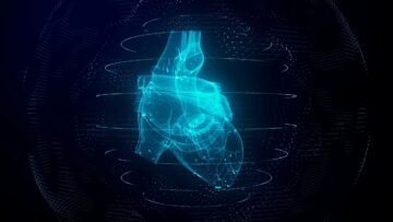 GE HealthCare toob turule uue tehnoloogia, mis vähendab MRI südame skaneerimist kuni 83%