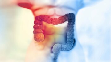 Paige launches new AI-driven digital assay for colon cancers