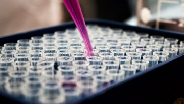 Seegene and Werfen to develop qPCR assays for Spain and Portugal