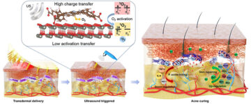 Microagulhas ativadas por ultrassom com nanopartículas antibacterianas para infecções de pele