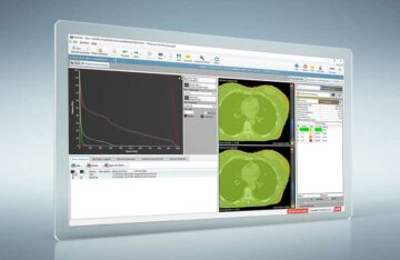 Assurance qualité automatisée des patients à l'aide du logiciel RadCalc pour les traitements de tomothérapie hélicoïdale à l'hôpital universitaire de Cologne - Physics World