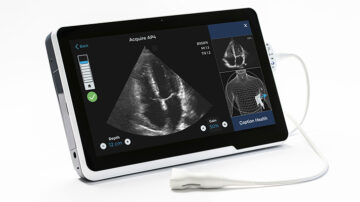 Guideline Issued for Ultrasound Imaging AI Software