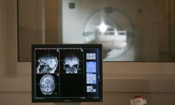 Η φασματοσκοπία MR χαρτογραφεί τον μεταβολισμό της γλυκόζης στον εγκέφαλο χωρίς να απαιτείται ακτινοβολία – Physics World