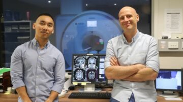 MRT-studie utmanar vår kunskap om hur den mänskliga hjärnan fungerar – Physics World
