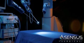 Asensus Surgical يواصل قيادة الابتكارات والنمو في الروبوتات الجراحية