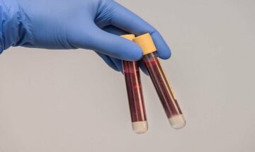 C2N Diagnostics เปิดตัวการทดสอบเลือด PrecivityAD2 ใหม่