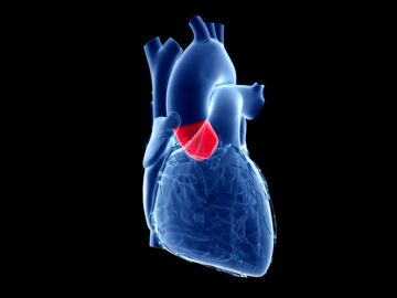 Mayor éxito clínico de la válvula cardíaca biomimética de Anteris Technologies