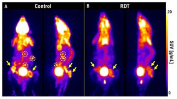 Радіодинамічна терапія: використання світла для покращення лікування раку – Physics World