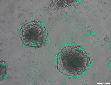 研究人员设计了能够检测肿瘤 DNA 的细菌