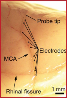 Micro-endovascular probe in cerebral artery of rat brain