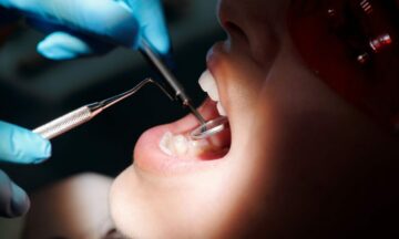 Dentists Are Concerned Patients Are Showing Up High