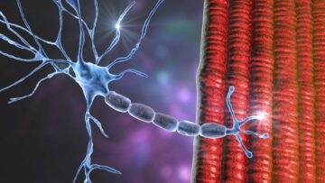 PathMaker začne testirati neinvazivno napravo za nevromodulacijo pri bolnikih z ALS