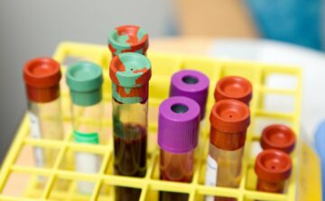 UC Santa Cruz desarrolla nueva plataforma de biopsia líquida para diagnóstico de cáncer