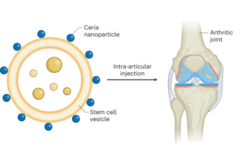 Biohybrid nanopartiklar för behandling av artrit - Nature Nanotechnology
