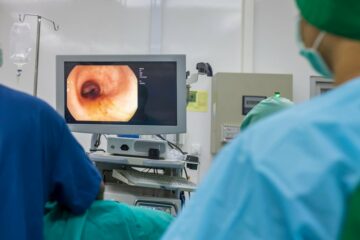 Creo Medical دستگاه UltraSlim را 18 ماه زودتر از موعد مقرر راه اندازی می کند