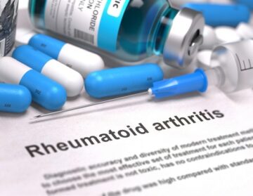 New nanoparticle-based system developed for comprehensive treatment of rheumatoid arthritis