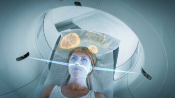 Philips lanceert AI-beeldvormings- en rapportagetools ter ondersteuning van de zorg voor prostaatkanker