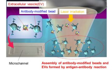 Deteksi nanopartikel yang berasal dari sel kanker yang diinduksi sinar laser super efisien