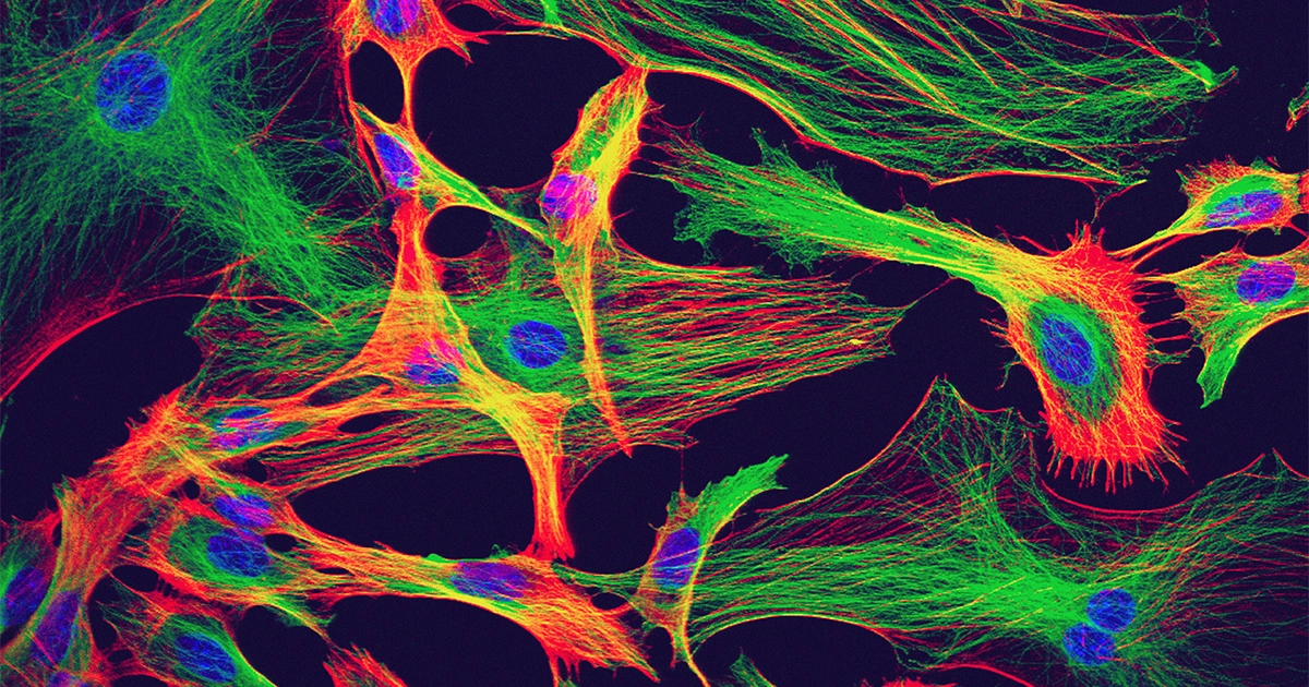 Disse cellene gir elektrisitet i hjernen. De er ikke nevroner. | Quanta Magazine