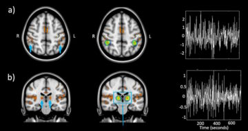 MRI สนามสูงพิเศษเผยให้เห็นว่าแสงสีน้ำเงินกระตุ้นสมองได้อย่างไร - โลกฟิสิกส์