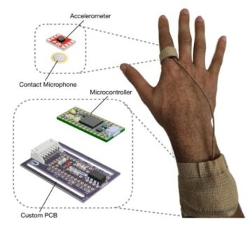 Wearable ring measures intensity and frequency of scratching – Physics World
