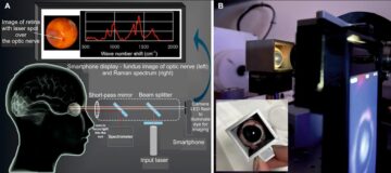 מכשיר כף יד משתמש בספקטרוסקופיה רשתית בטוחה לעין כדי לאבחן פגיעה מוחית - Physics World