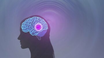 Nexalin planea ensayos en EE. UU. del dispositivo de neuroestimulación cerebral profunda HALO