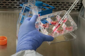 Tempus lanceert MRD-test voor onderzoek naar colorectale kanker