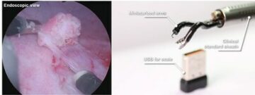 Agilis Robotics представляет новаторские достижения в эндолюминальной хирургии | Биокосмос