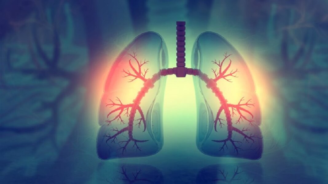 吸入的抗生素可以将药物输送到肺部深处