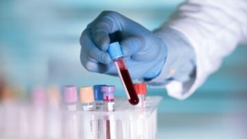 Blodtillgång och efterfrågan: hur upprätthållande av blodlager är avgörande för sjukhus