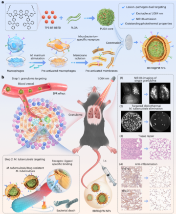 Thérapie photothermique de la tuberculose utilisant des nanoparticules recouvertes de membranes de macrophages pré-activées - Nature Nanotechnology
